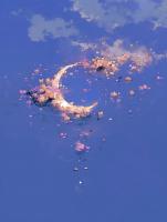 脑瘫小孩不再喊痛后，爸爸妈妈后悔了